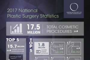 ASPS Most Popular Plastic Surgery Procedures 2017 - Tannan Plastic Surgery