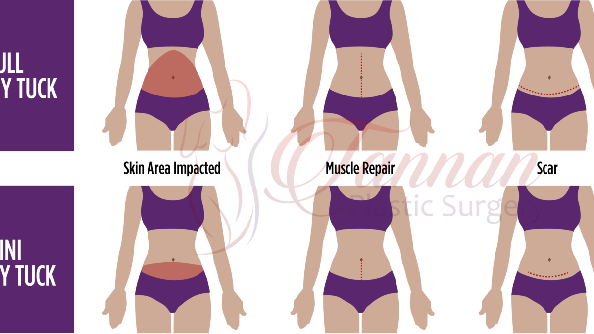 what hurts more lipo or c-section What Can I Do About My C-Section Scar and Pooch? - Tannan Plastic Surgery