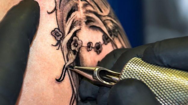 Remove a Tattoo - Tannan Plastic Surgery