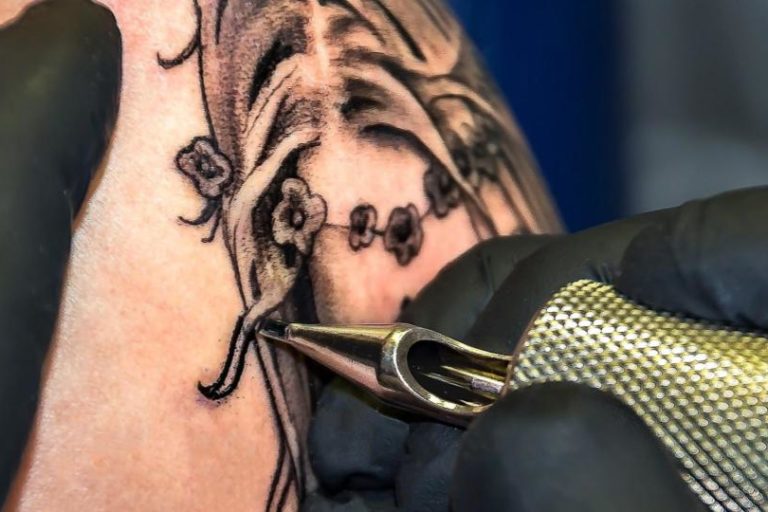 Remove a Tattoo - Tannan Plastic Surgery