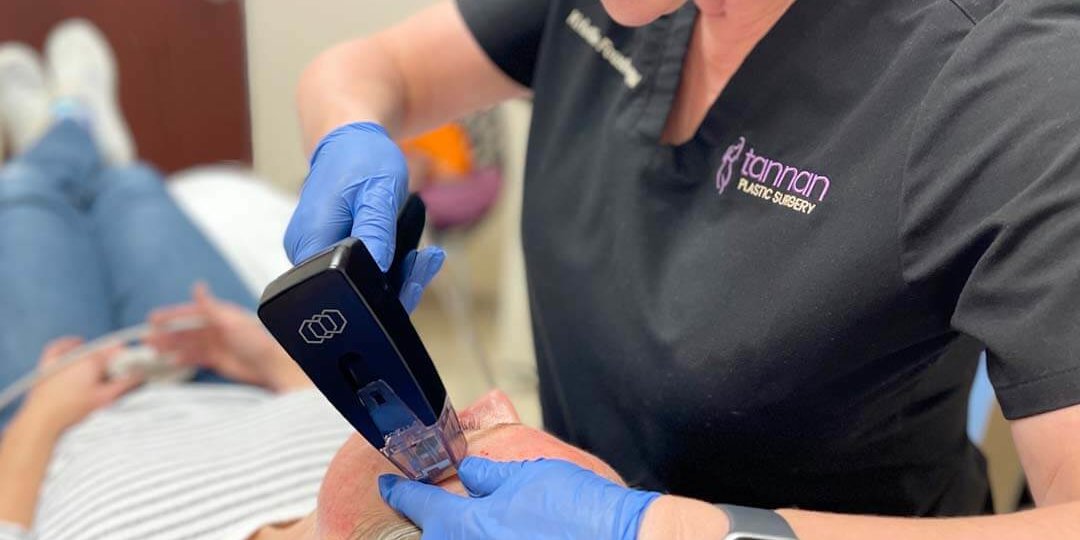 Morpheus8 Microneedling All You Need to Know – Tannan Plastic Surgery Morpheus8 Microneedling All You Need to Know - Tannan Plastic Surgery