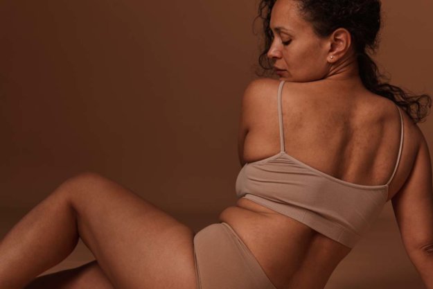 Treatments for Stretch Marks - Tannan Plastic Surgery