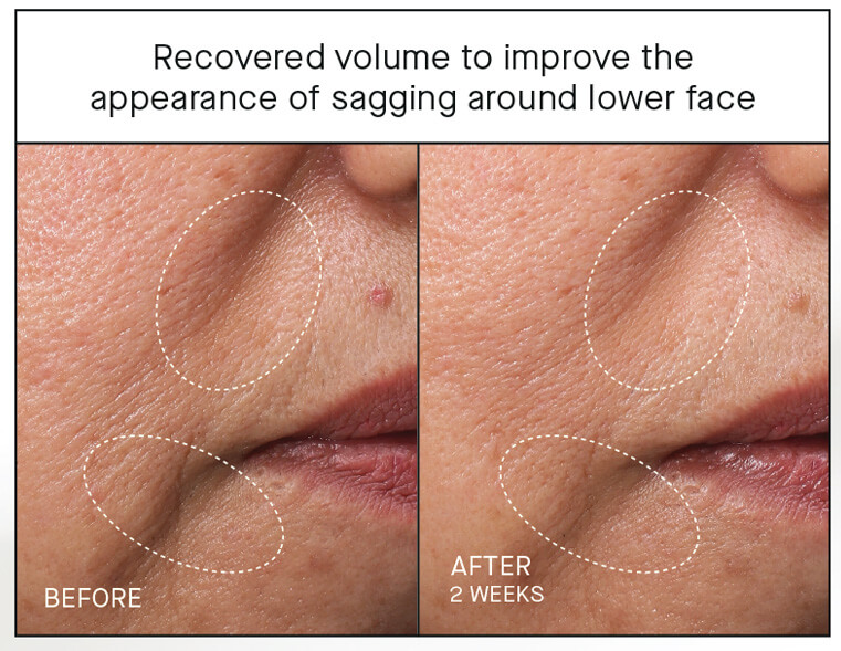 Ourself-Before & After 9 Ourself before & after recovered volume
