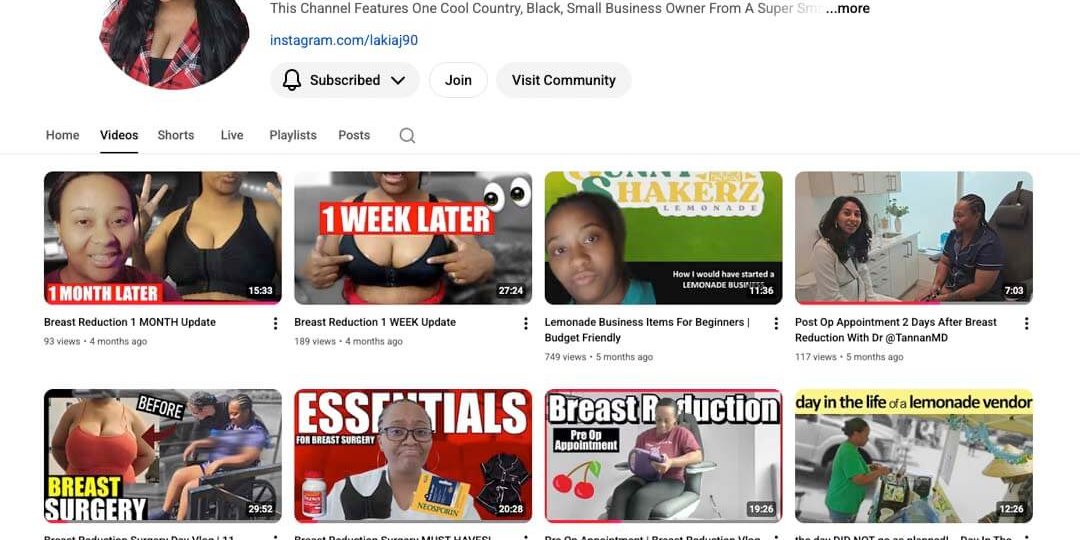 Read about KiaTV's breast reduction surgery experience at Tannan Plastic Surgery