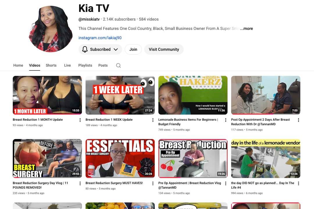 Read about KiaTV's breast reduction surgery experience at Tannan Plastic Surgery